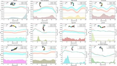 Tractography in Type 2 Diabetes Mellitus With Subjective Memory Complaints: A Diffusion Tensor Imaging Study